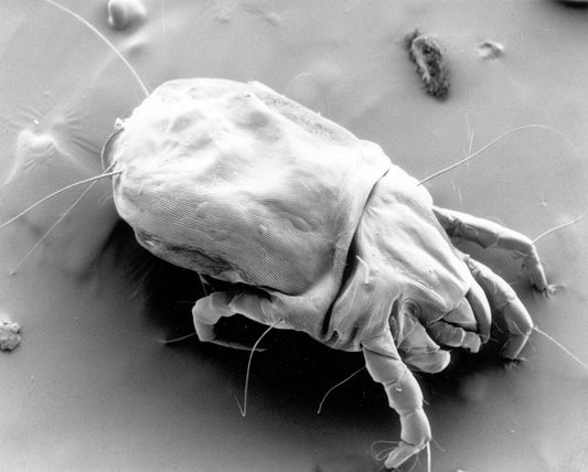 The Science of Dust Mite Allergy