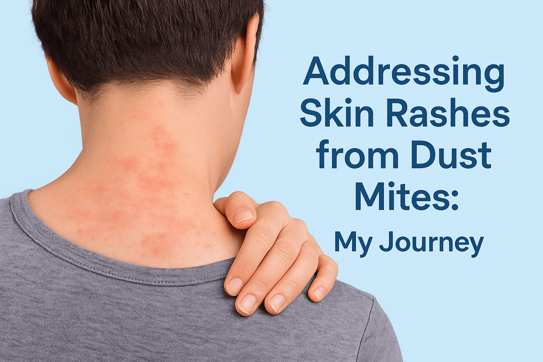 Addressing Skin Rashes from Dust Mites - My Journey