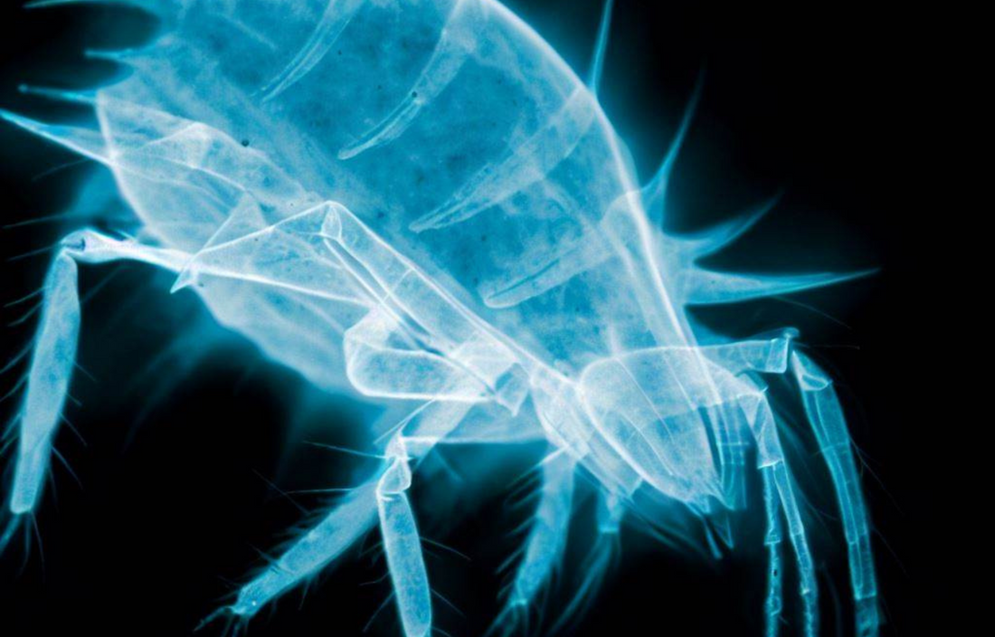Dust mite bites or bed bug bites?