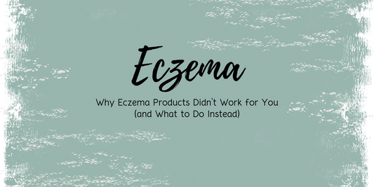 Why Eczema Products Didn’t Work for You (and What to Do Instead)